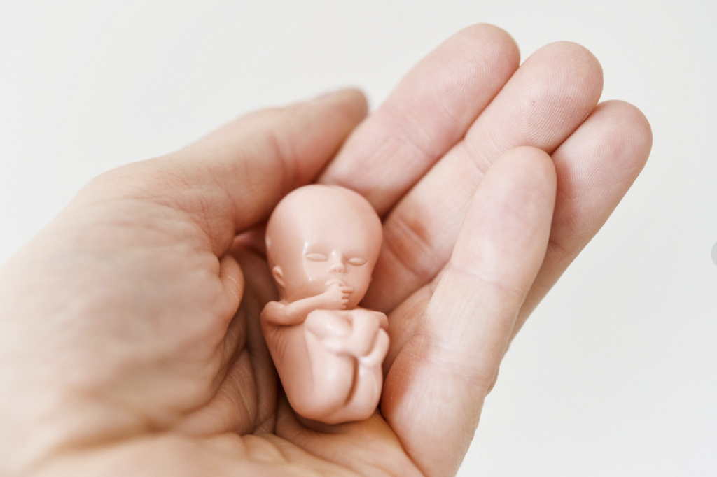 Aborto - Só quem dá a vida tem direito de tirar
